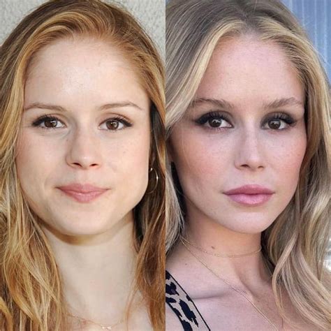 erin moriarty before surgery|Erin Moriarty Plastic Surgery: Analysis and Expert。